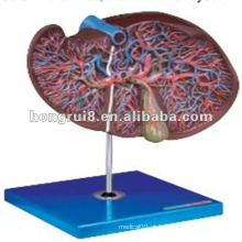 Fígado Amplificado ISO, Modelo de Anatomia da Vesícula Biliar HR / A12009
